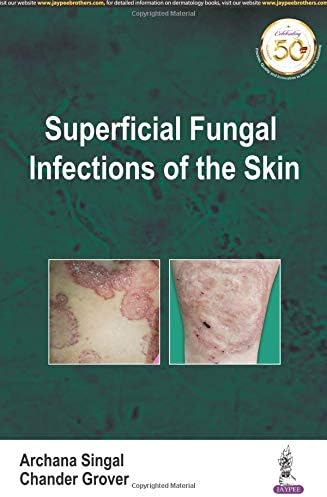 Superficial Fungal Infections of the Skin (POD)