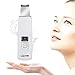 Skin Scrubber, LOZAYI Portable Exfoliator/Blackhead Remover Face Skin Spatula,Cutin Peeling instrument, Comedones Extractor Pimple Cleanser Rechargeable for Pore Deep Cleansing and Facial Lifting Tool