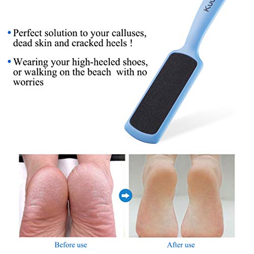 Foot File Foot Callus Remover, Double-Sided Colossal Pedicure Foot RASP, Dead Skin Exfoliator for Feet (Pack of 4) - Thumbnail 3