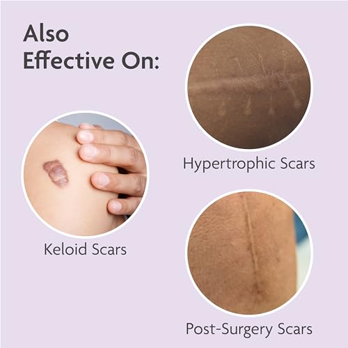 TriLASTIN Maternity Stretch Mark Prevention Cream (4oz) Bundle with Sillicone Scar Sheets (6 count) | Pregnancy Must-Have | Safe and Hypoallergenic Gift for First-time Moms | Postpartum Essentials