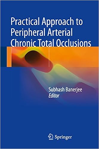 Amazoncom Practical Approach To Peripheral Arterial - 