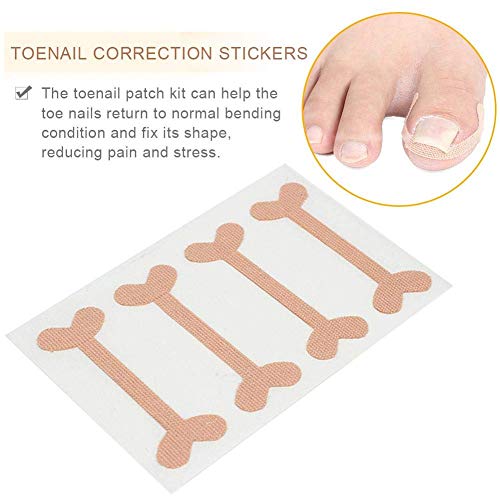 Ingrown Toenails Correction Patch, 20 PCS/32 PCS Physical Straightening