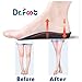 Dr. Foot's 3/4 Length Orthotics Insoles - Best Insoles for Corrects Over-Pronation, Fallen Arches, Fat Feet - Plantar Fasciitis, Heel Spurs and Other Foot Conditions -1 pair (S - W7-8.5 | M5.5-7)