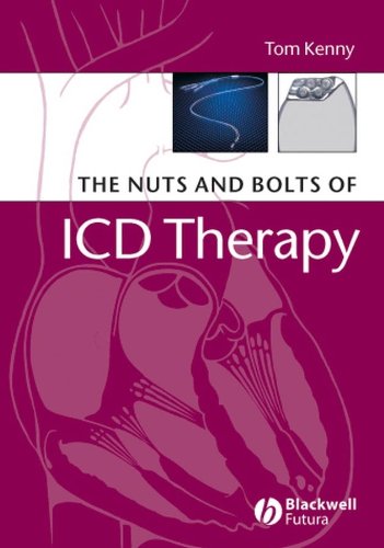 The Nuts and Bolts of ICD Therapy - Thumbnail 3