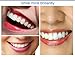 High-tech Dental Orthodontic Braces - Transparent Soft and Hard - for Adults Child Teeth Straightening