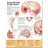 Understanding Stroke Spanish Paper Chart, Anatomical Chart Company Staff, 1587799898