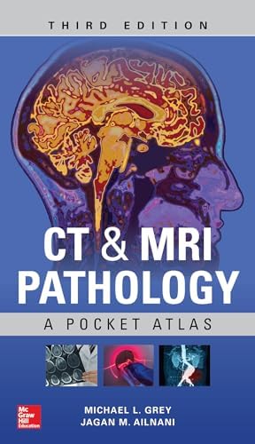 Color Atlas of Microneurosurgery: 9783131111029: Medicine & Health