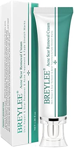 Picture of YOOJ Acne Repair Cream Oil Control Pore Minimizing & Skin Brightening ...