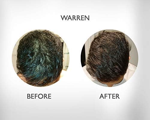 Regrowz Volume Conditioner 200ml, Biotin Hair Thickening Conditioner for Fine & Thinning Hair - Image 5