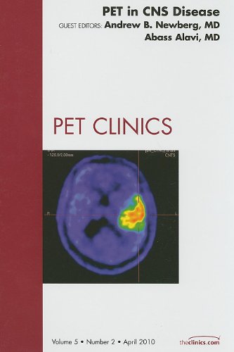 PET in CNS Disease, An Issue of PET Clinics, 1e (The Clinics: Radiology)