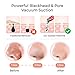 NOEL Blackhead Remover - Pore Vacuum Suction Cleanser & Pimple Popper - Comedone Extractor Acne Removal Cleansing Tool - Includes 5 Heads, 2 Silica Gel Rings, 5 Sponges - Unisex Facial Clean Kit