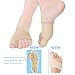 Doact Bunion Corrector Sleeve for Bunion Protector and Pain Relief, Orthopedic Gel Bunion Pad for Women Men Toe Splint Support for Hallux Valgus, Hammer Toes
