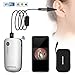 Wireless Ear Otoscope, DEPSTECH Detached Digital Ear Scope Ear Inspection Camera Earwax Cleaning Tool with 6 LED Lights for Android Devices, iPhone & iPad, Windows & MAC PC Computer