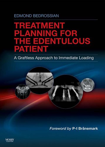Implant Treatment Planning for the Edentulous Patient: A Graftless Approach to Immediate Loading, 1e