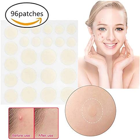 1Pack Acne Pimple Patch Spot Cover Nature Patch Hydrocolloid Facial Stickers Quick Healing Pimples Beauty Tools (96Patches)