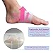 Lewonde 2 Plantar Fasciitis Arch Support Braces with Foot Massage Nodes - 2 Heel Spur Pain Relief Inserts for Flat Feet,High Arches,Overpronation,Foot Care (S/M, White Brace)