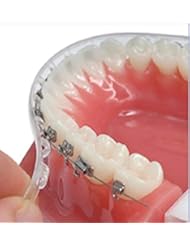 TecnidentUSA Clip-On Comfort Lip Shield/Mouth Protector Guard For Braces - Orthodontic Dental Wax Alternative - 2019 New and Improved