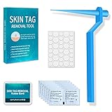 Micro Skin Tag Remover Kit, Painless Skin Tag