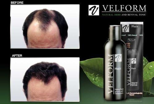 Velform Hair Grow Tonic Stimulates Hair Growth Stop Hair Loss Hair Fall 200 Ml. by Velform Hair Grow