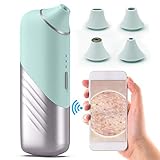 Visual Blackhead Remover，Pore Vacuum Blackhead Remover with Camera Rechargeable 