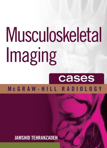 MUSCULOSKELETAL IMAGING CASES