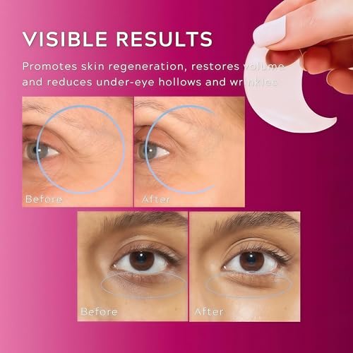 Artiwell Cementere Calcium Volume Multi Balm + Calcium Volume Eye Patches, Calcium Multi Balm Stick, Under Eye Masks for Puffy Eyes, Dark Circles, Wrinkles, Firming & Anti Aging Korean Skincare Set