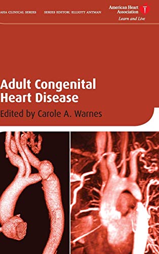 Adult Congenital Heart Disease by 