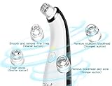 Electric Blackhead Remover, QQCute Comedo Suction Microdermabrasion Machine Rechargeable Facial Pore Cleaner Skin Peeling Machine Comedone Extractor Tool Black