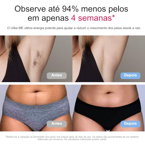 Depilador a Laser IPL Ulike ME Luz Pulsada Indolor Ice Cooling Resfriamento em Safira, 4 Modos, Disparo Automático (3x/s), Depilação Corporal e Facial, Uso Doméstico, ANVISA, Bivolt, Presente Ideal Unissex