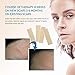 SIlicone Scar Sheets, 4pcs