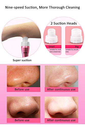 Home Facial Skin Cleaning Machine, Blackhead Remover, Water Massage Rinse and Suction Combination Skin Care Tool, Vacuum-Pore Cleaner, Pimple Acne Extractor Tool Suitable for Women and Men