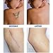 Concealer To Cover Tattoo/Scar/Birthmarks/Vitiligo, Professional Waterproof Tattoos Cover Up Makeup Concealer Set, Dark Spots Concealer Kit
