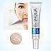 Anti Acne Removal Cream,Kemilove Effective Face Skin Care Removal Cream Acne Spots Scar Blemish Marks Treatment