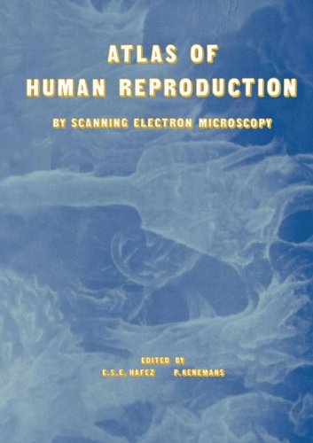 Atlas of Human Reproduction: By Scanning Electron Microscopy