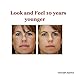 Appolus Microdermabrasion Machine Wireless- Premium Diamond Microdermabrasion Kit For Flawless Lifted Skin-2 Different Size Diamond Tips-5 Heads-Blackhead Blemishes Remover-Pore Lines Wrinkles Sagging