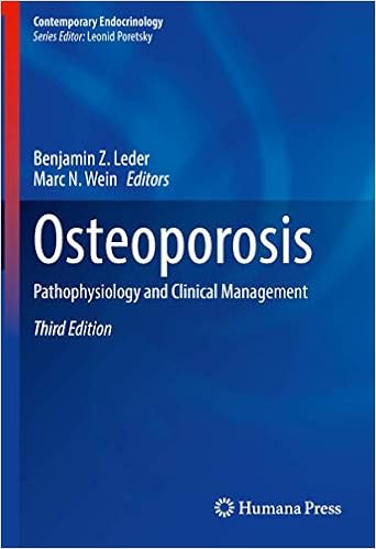 Osteoporosis Pathophysiology And Clinical Management Contemporary Endocrinology 9783319692869 Medicine Health Science Books Amazon Com