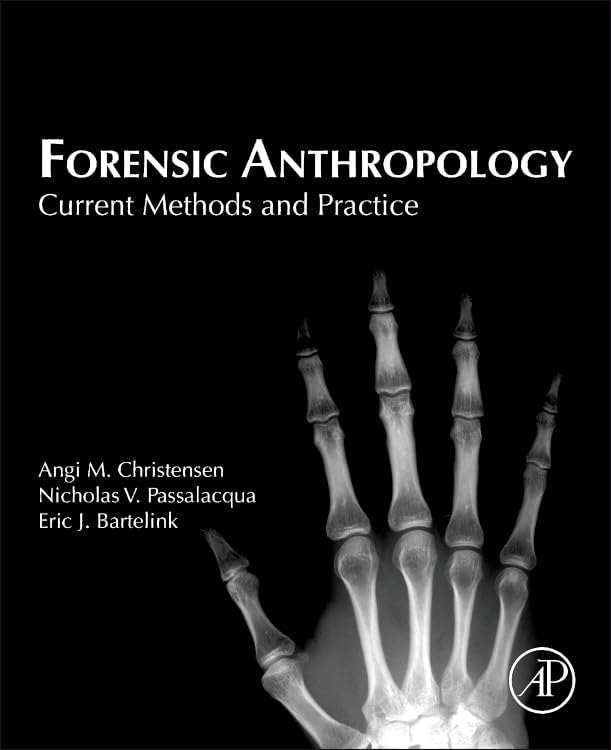 Human Osteology: 9780123741349: Medicine & Health Science Books