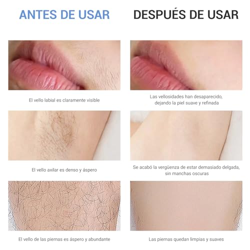 Depilación Láserpara Mujeres, Depilación IPL con Función de Enfriamiento, Luz Pulsada Depilacion Profesional, 999999 Destellos, 9 Niveles Indolora, Unisex, para Axilas, Piernas, Brazos y línea del Bikini