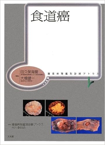 食道癌 腫瘍病理鑑別診断アトラス 腫瘍病理鑑別診断アトラス刊行委員会 海誉 田久保 健一 大橋 本 通販 Amazon