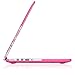 Kuzy - Lace Neon Pink Case for Older MacBook Pro 13.3