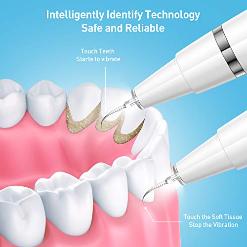 Plaque Remover for Teeth, Sonic Dentifrice Tartar Remover Dental