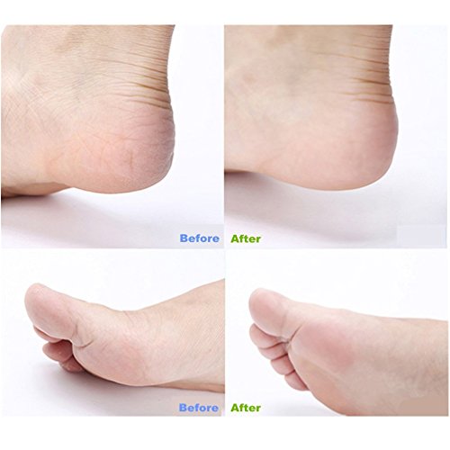 PRETTY SEE 10 in 1 Foot File Callus Remover Stainless Steel Pedicure Rasp Tools