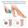 Foot-File-ANJOCARE-Nano-Glass-Callus-Remover-for-Dry-Hard-Skin-Portable-Handheld-Feet-Scraper-for-Coarse-Cracked-Heel-Beauty-Foot-Care-Pedicure-Removal-Tool-for-Women-Men-Home-Blue Foot File, Nano Glass Hard Skin Callus Remover, Foot Scraper Salon Home Pedicure Tool for Foot Beauty Care, Can Be Used…
