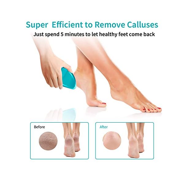 Foot-File-ANJOCARE-Nano-Glass-Callus-Remover-for-Dry-Hard-Skin-Portable-Handheld-Feet-Scraper-for-Coarse-Cracked-Heel-Beauty-Foot-Care-Pedicure-Removal-Tool-for-Women-Men-Home-Blue Foot File, Nano Glass Hard Skin Callus Remover, Foot Scraper Salon Home Pedicure Tool for Foot Beauty Care, Can Be Used…