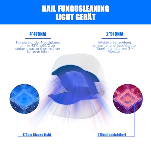 Laser Nail Fungus Fast Action High Efficiency - Cold Laser Therapy Treatment of Multiple Blue Comfortable Toes and Feet Infrared Therapy - Laser Nail Fungus