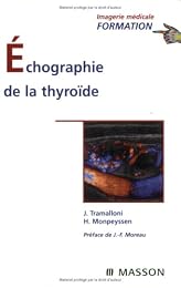 Échographie de la thyroïde