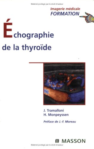 Échographie de la thyroïde