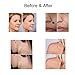 Portable Dark Spot Removal, Professional Tattoo Remover Tool for Skin Tag Freckles Dark Spot Skin Pigmentation with Replaceable Needles