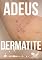 Livro Adeus Dermatite: Acabe com essa Condição de Pele Desagradável