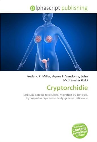 Amazon Fr Cryptorchidie Scrotum Ectopie Testiculaire Migration Du Testicule Hypospadias Syndrome De Dysgenesie Testiculaire Miller Frederic P Vandome Agnes F Mcbrewster John Livres Amazon Fr Cryptorchidie Scrotum Ectopie Testiculaire Migration Du Testicule Hypospadias Syndrome De Dysgenesie Testiculaire Miller Frederic P Vandome Agnes F Mcbrewster John Livres
